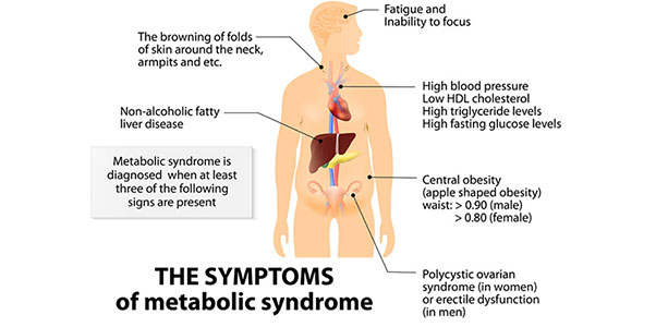 Liver Dysfunction and the Metabolic Syndrome